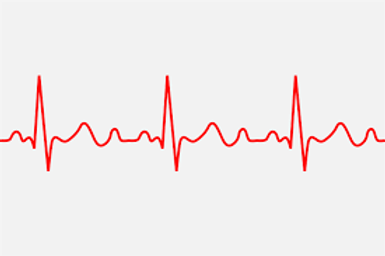 arrhythmias.png