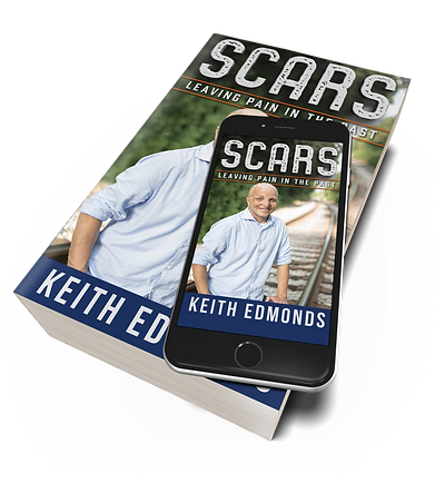 5x8-Paperback-book-iphone-Mockup-SCARS.p