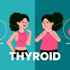 Hashimoto: Por qué retirar Lácteos y Soya (Salud Celular)