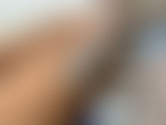 JNHOJE - Implanon passa a ser ofertado no SUS e Itabela inicia processo de implantação do método contraceptivo