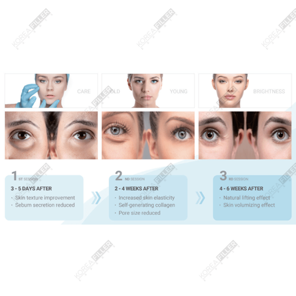 Thumbnail: Ami Eyes PDRN 2ml. Collagen stimulator. 