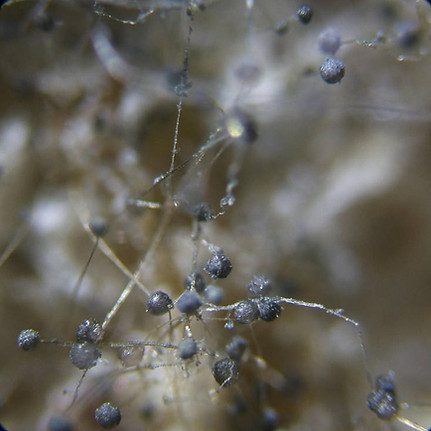 black_mold_under_a_microscope_by_purplemutant_d98xoy9-fullview.jpg