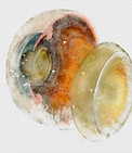 cataracts cataract surgery eye