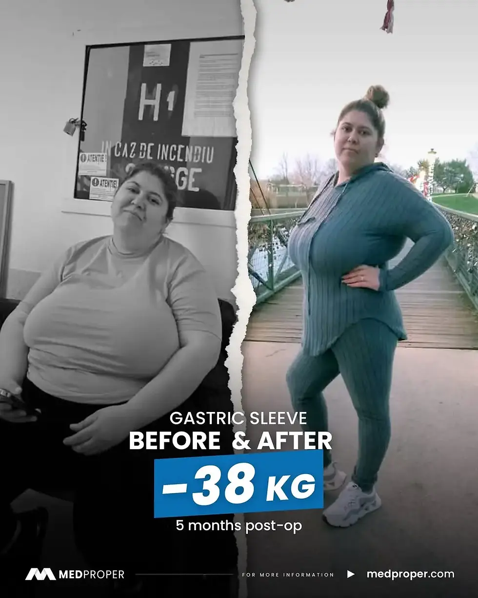 Before and after gastric sleeve transformation showing 38 kg weight loss in a woman