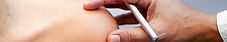 Moxibustion Treatment | Healthwise Chinesemed | Acupuncture Chinese Medicine Clinic Hong Kong