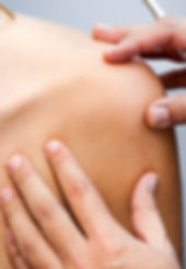 Shoulder Pain