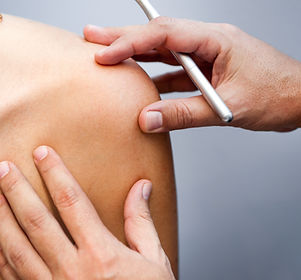 antiwrinkle treatment