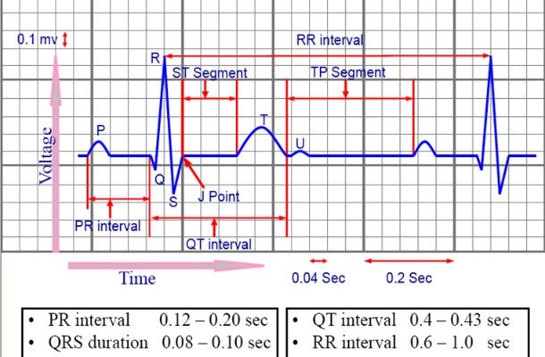 Exploring ECG Data: PTB-XL for Training Generative Models