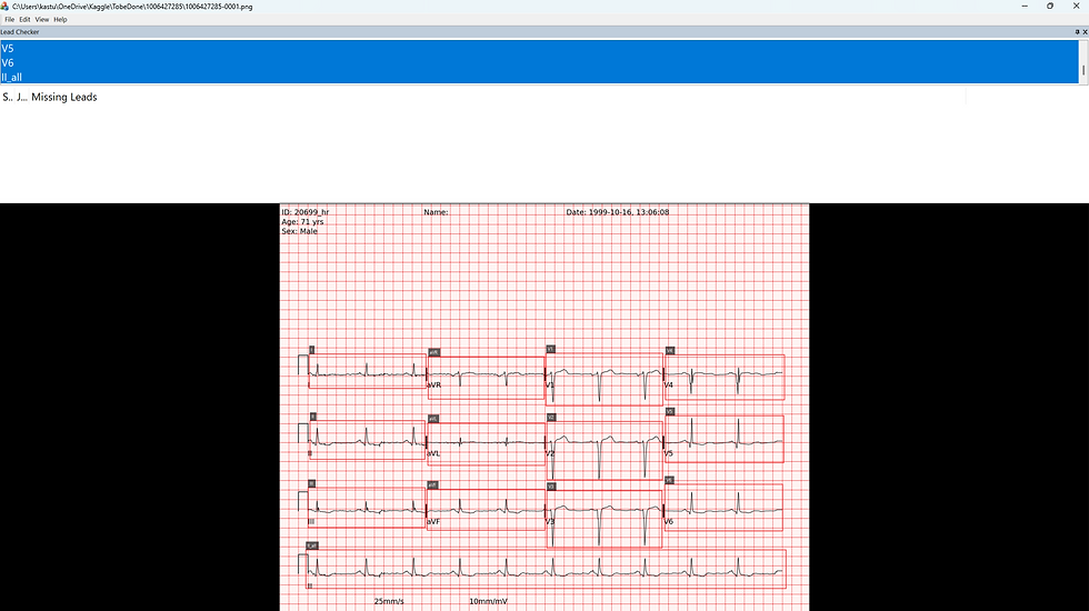 While the previous figure shows manual annotation of ECG images, this view presents the LeadChecker dockable window — a folder‑level utility that verifies whether all leads in each training image sets have been annotated with bounding boxes. After selecting a training folder, LeadChecker identifies images in a folder with missing annotations and allows direct navigation to those files for quick correction.