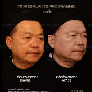 TRI-REBALANCE PROGRAMME