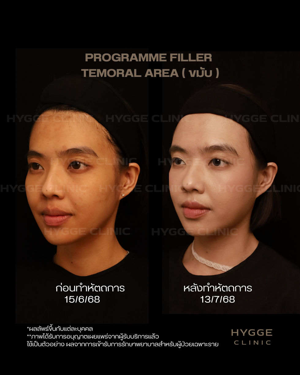 ก่อนทำหัตถการ.zip - 1.jpeg