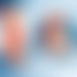 Warum schmerzt die Achillessehne so häufig?