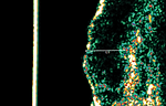 Fraction8_2-ultrasound_crop.png