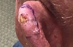 Ear_1-simulation_crop.png
