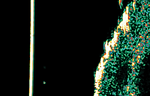Followup_3-ultrasound_crop.png