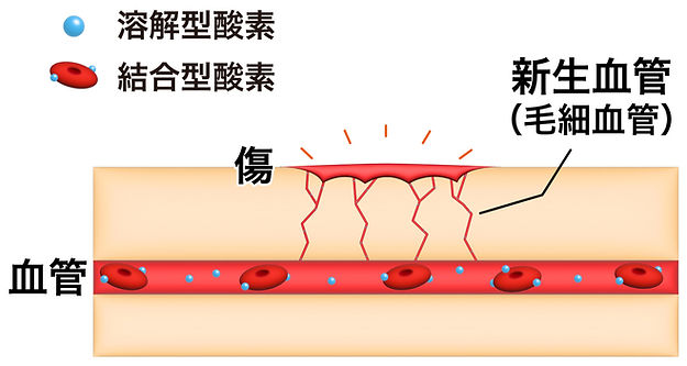 溶解型酸素と怪我の関係_edited.jpg