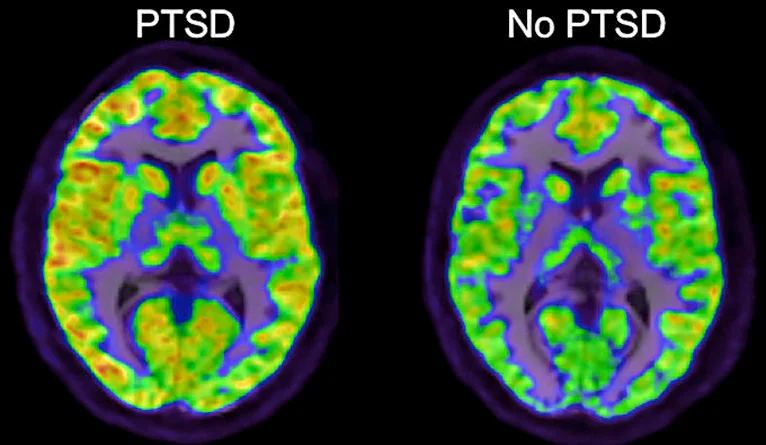 a close-up of a brain scan