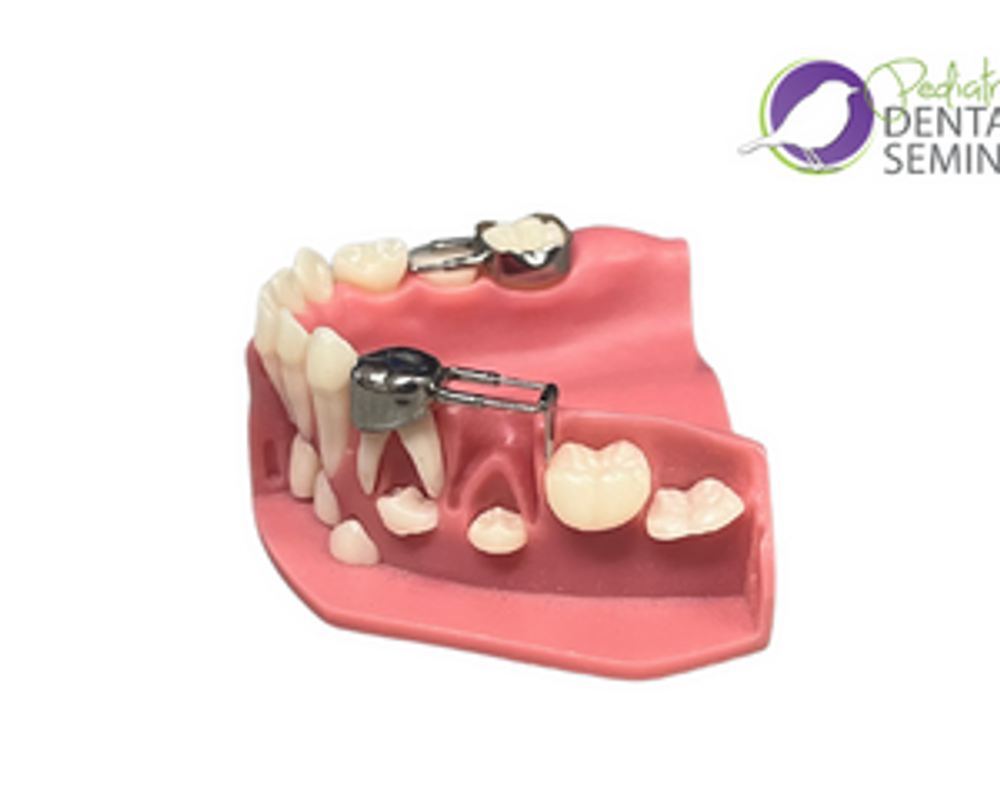 Simple Space Maintenance Pediatric Dental CE