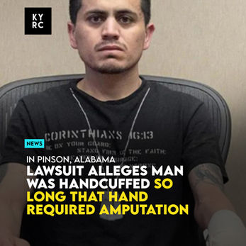 Lawsuit Alleges Man Was Handcuffed So Long That Hand Required Amputation