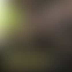 Black Man Pistol-Whipped & Strangled By Officer Testifies That He Feared For His Life