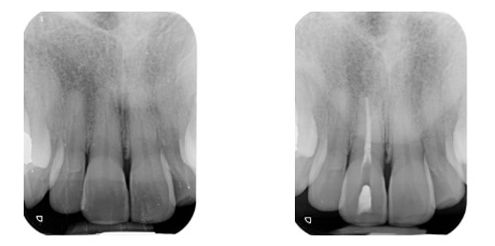 Radiografia Caso 3