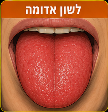 לשון אדומה