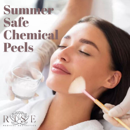 Why Spring is the PERFECT time for a Chemical Peel