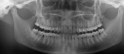 Screenshot 2025-11-23 083454.png