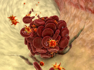 Médico cita 4 vitaminas que melhoram a circulação e previnem trombose