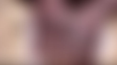 Variole de singe: la Russie va apporter son soutien en Afrique avec des tests et formations