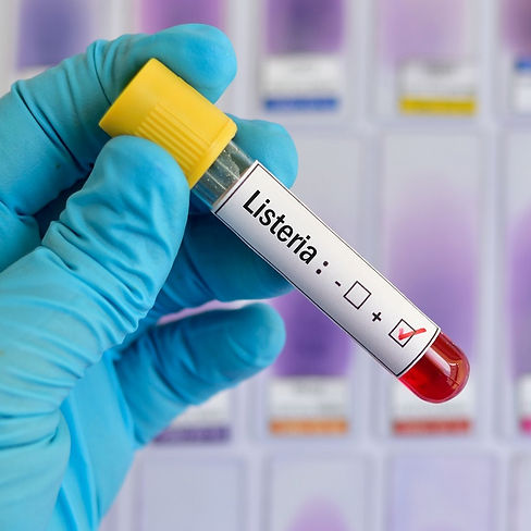 637643578861563024Listeria-positive-929503314_2807x1744 (2).jpeg