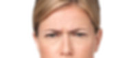 2 Botox Before.jpeg