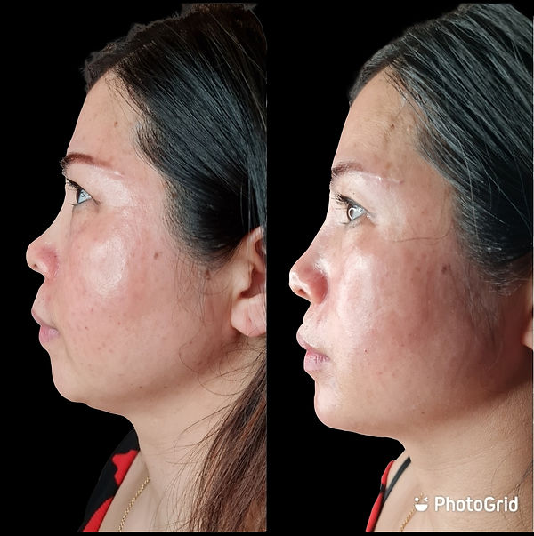 MYDOCTOR Aesthetics Clinic In Islington London N1 2RY