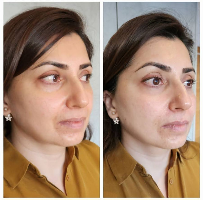 MYDOCTOR Aesthetics Clinic In Islington London N1 2RY