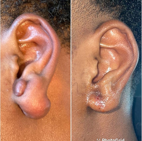 MYDOCTOR Aesthetics Clinic In Islington London N1 2RY