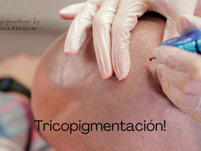 "Tricopigmentación: Innovadora Técnica para Restaurar la Apariencia Capilar"