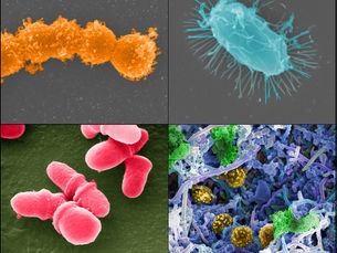 The Gut Microbiome-the Key to Health and Cognition, Part 1