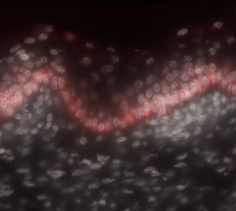 Developing skin appendages