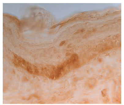 in vivo enhancer screening