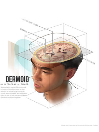 Brain cross section
