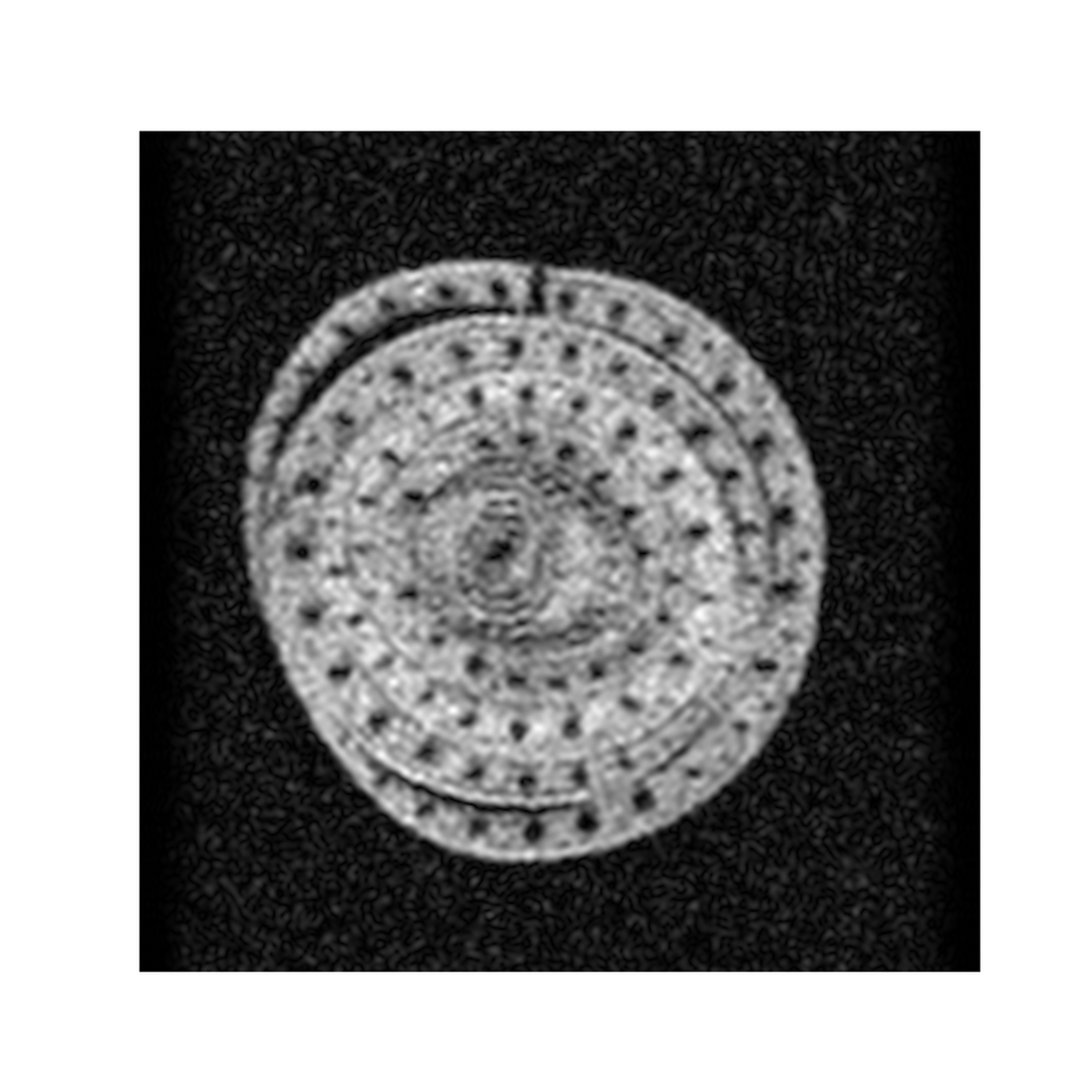 MRI of Lemongrass