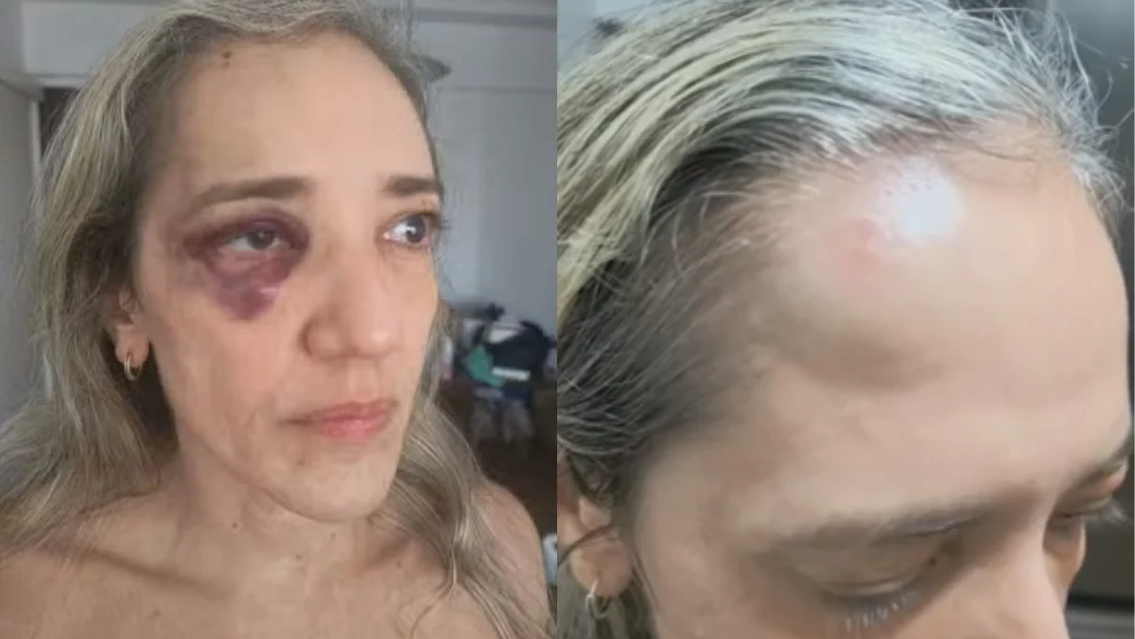 Mulher agredida por motociclista de app desistiu de corrida por capacete sem viseira.