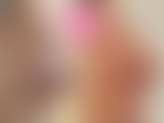 Tecnica di modellamento non chirurgica del naso: il Rinofiller