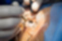 eye surgery cataract.jpg