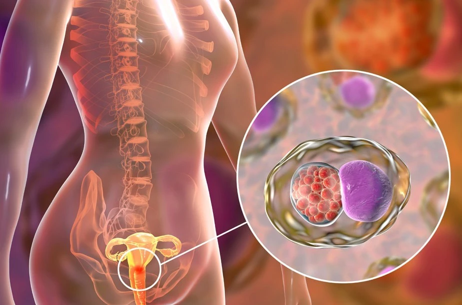 Cervical cancer