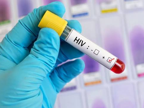 HIV awareness outreach poster.