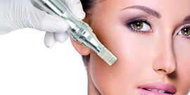 Microneedling-TF-1500x750(1).jpg