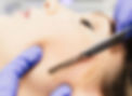 dermaplaning-5e13a828e1998.jpg