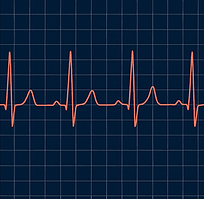 Elektrokardiogramm auf Gitterhintergrund.png