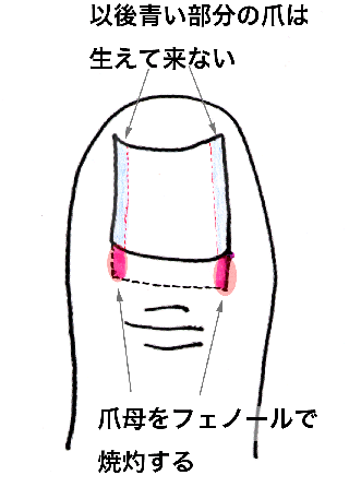 Nailfm.gif